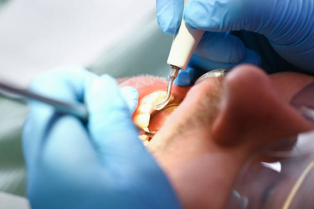 Best Cosmetic Emergency Dentistry in Belmont, WI