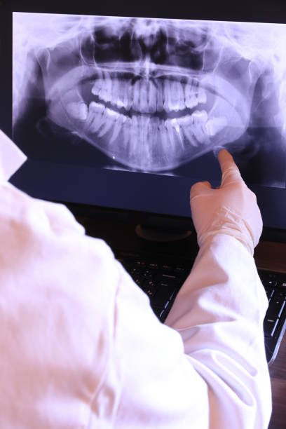 Best Emergency Denture Repair in Belmont, WI