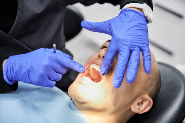Best Emergency Dental Care for Broken or Chipped Teeth in Belmont, WI